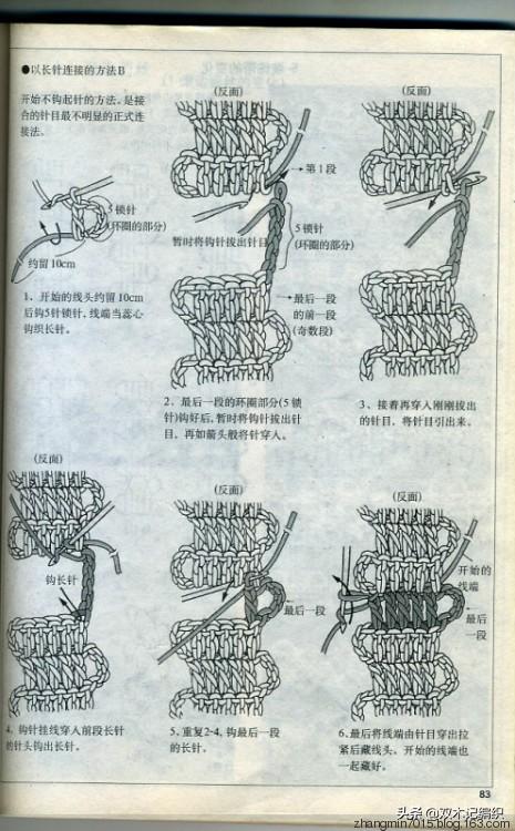 革新手术缝合技术，最新缝针法揭秘