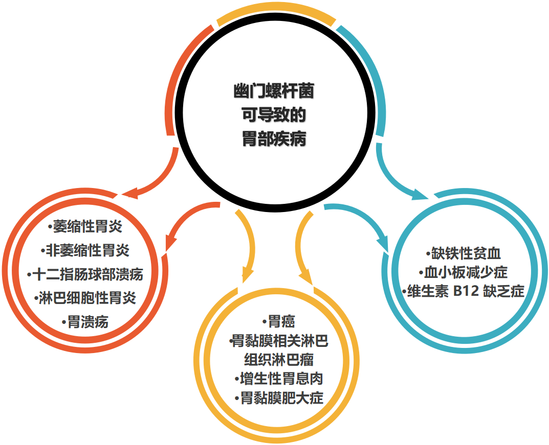 幽门螺杆菌最新治疗方法研究揭秘